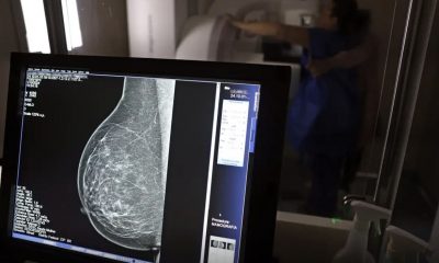 falta-de-acesso-a-mamografos-l