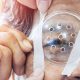transplante-de-cornea-33-mil-p