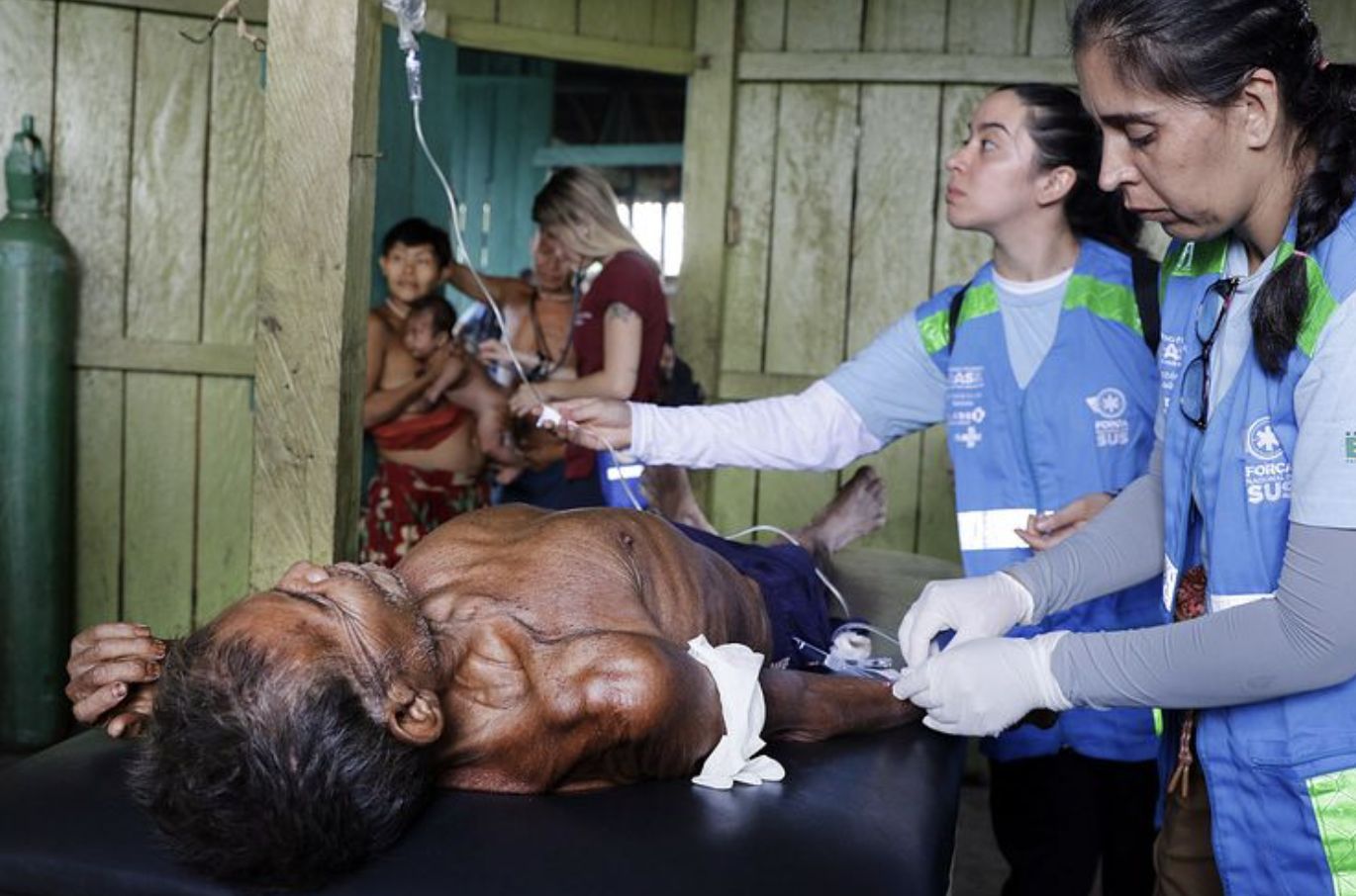 mortes-em-terra-yanomami-caem-