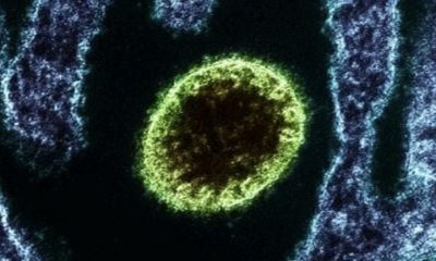 surto-de-virus-letal-nipah-dei