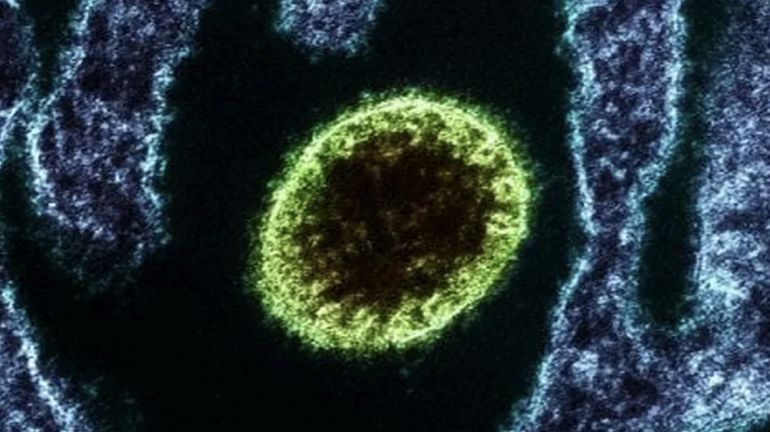 surto-de-virus-letal-nipah-dei