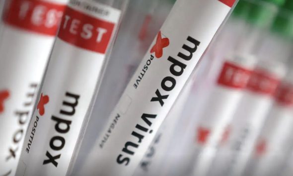 sobe-para-140-numero-de-casos-