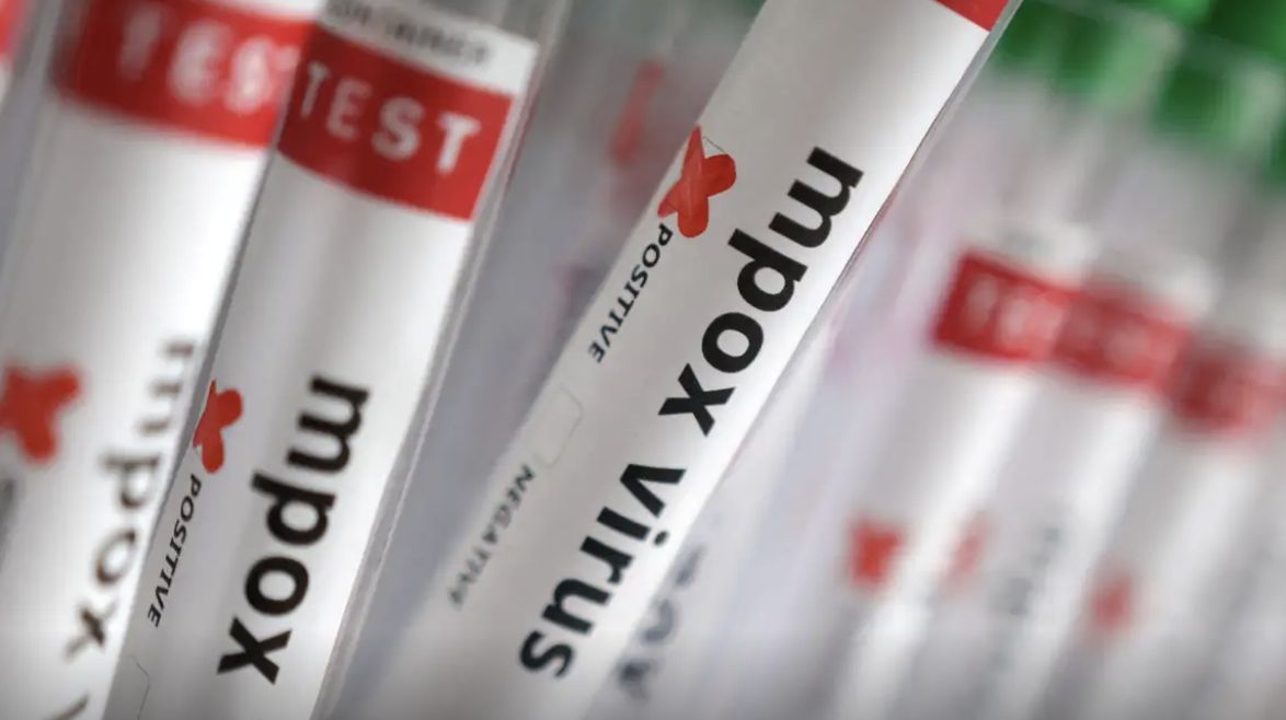 sobe-para-140-numero-de-casos-