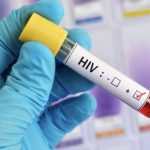 onu-teme-repique-da-aids-com-q