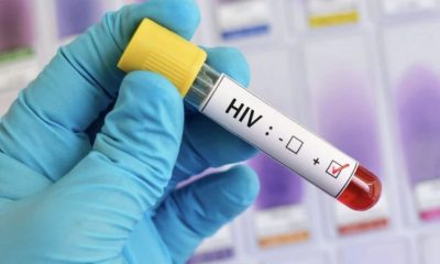 onu-teme-repique-da-aids-com-q