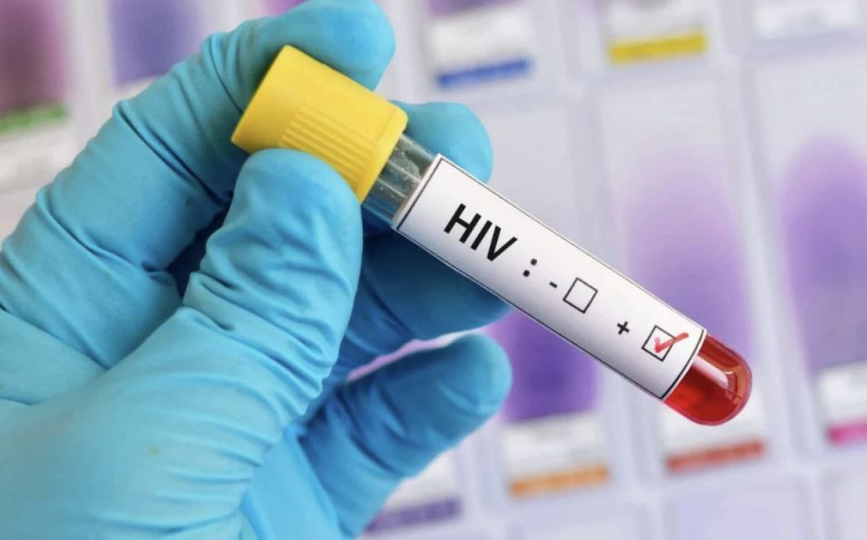 onu-teme-repique-da-aids-com-q