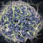 surto-de-ebola-no-congo-e-de-d